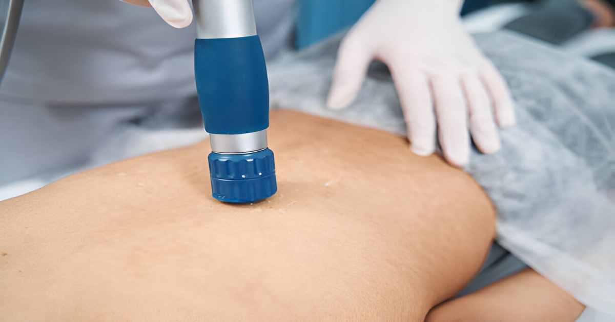 Cellulogia: The Natural Solution for Smoother Skin