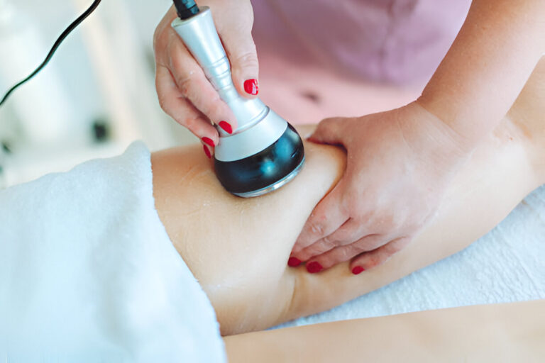 Cellulogia: The Natural Solution for Smoother Skin